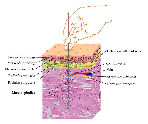 Acupuncture Needle Depth Diagram